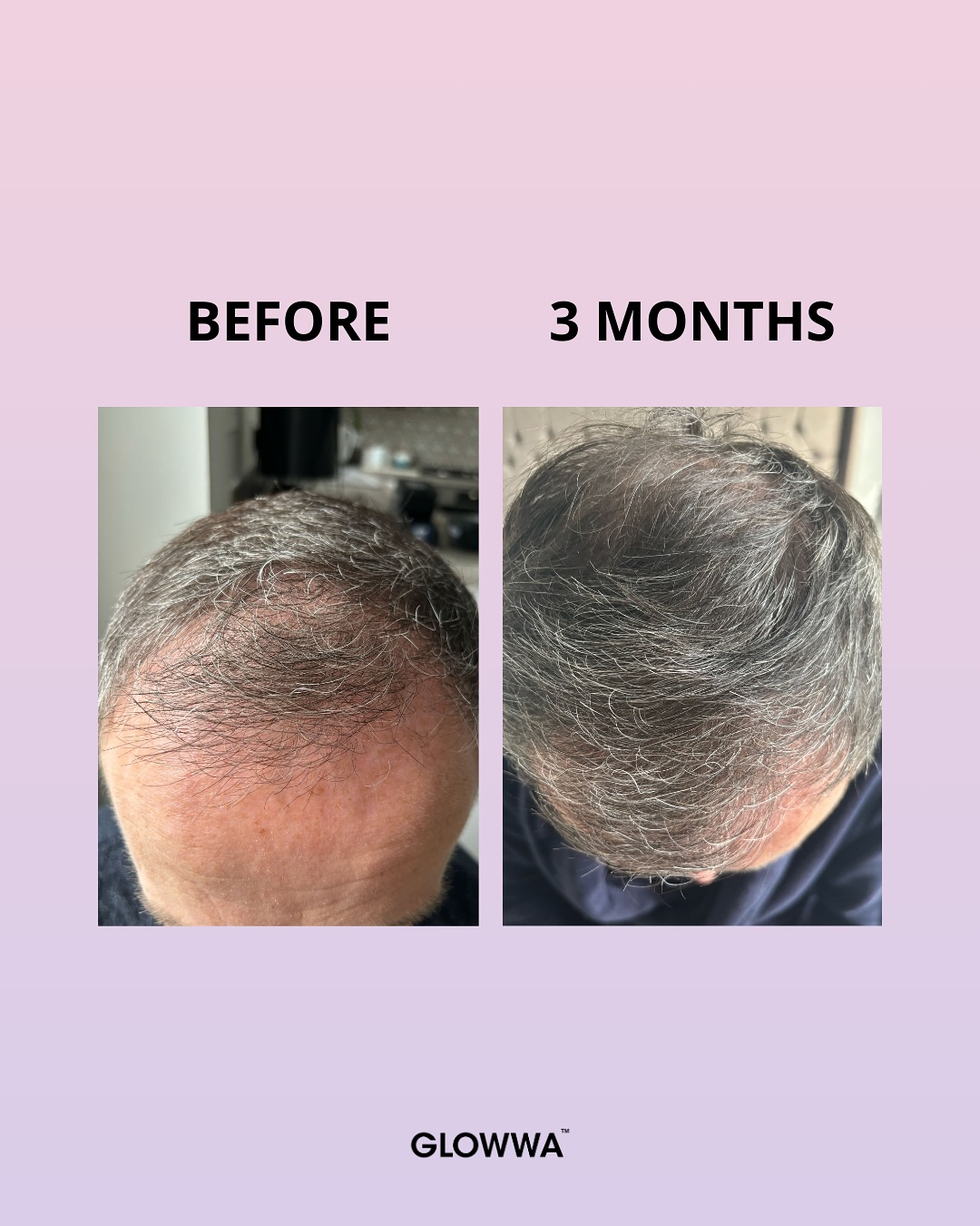 GLOWWA Before & After 1 GLOWWA Before & After 1