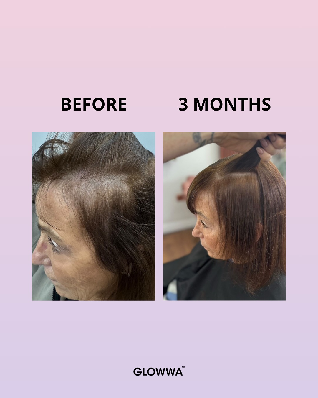 GLOWWA Before & After 2 GLOWWA Before & After 2